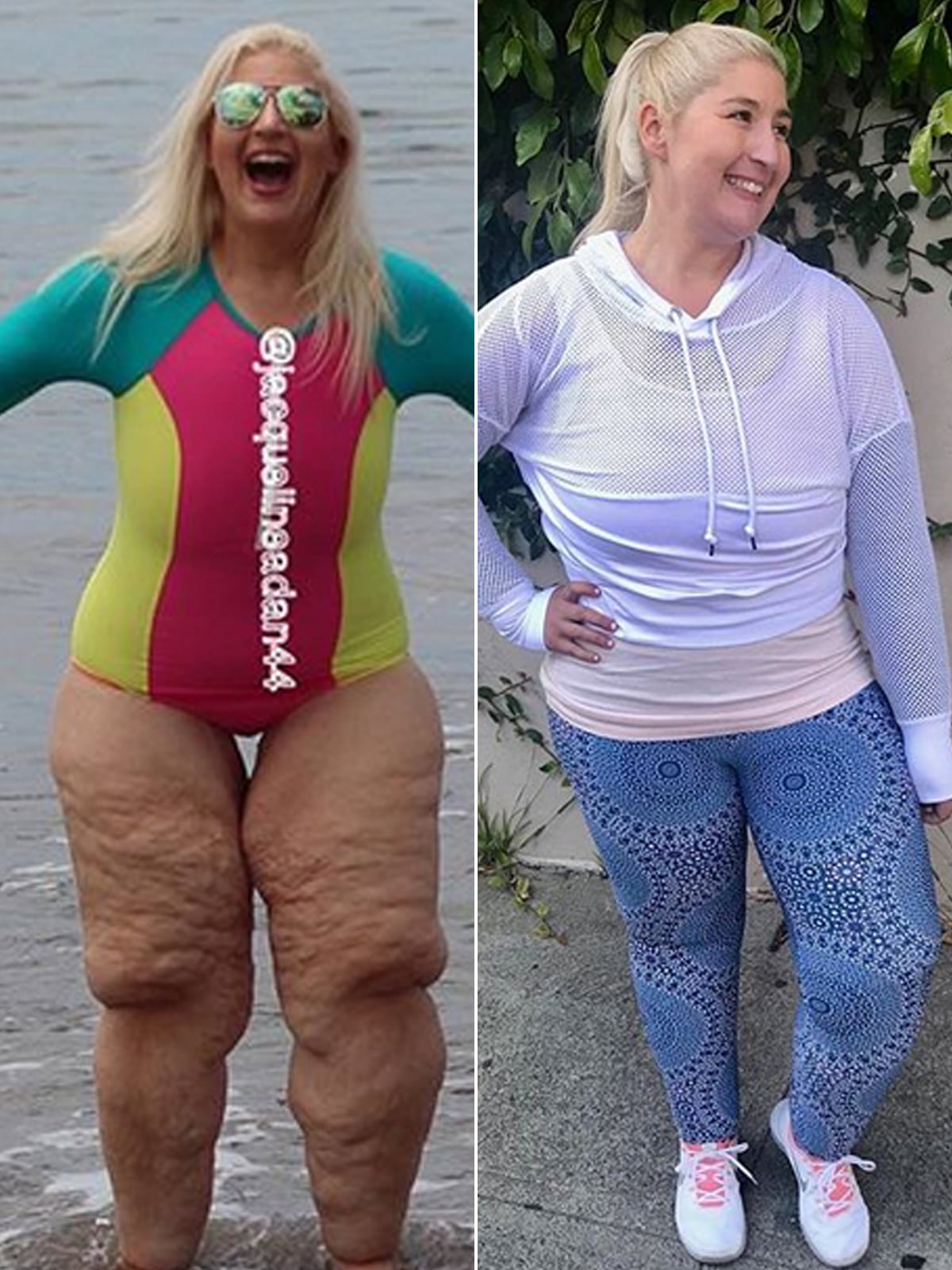 Woman Who Lost 350 Lbs. 